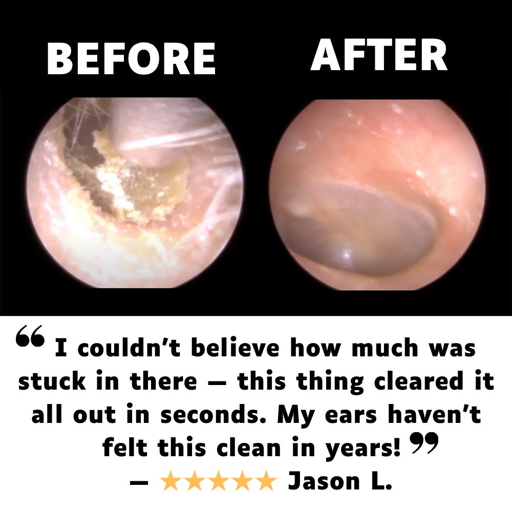 HydroClear Pro™ Ear Cleaner